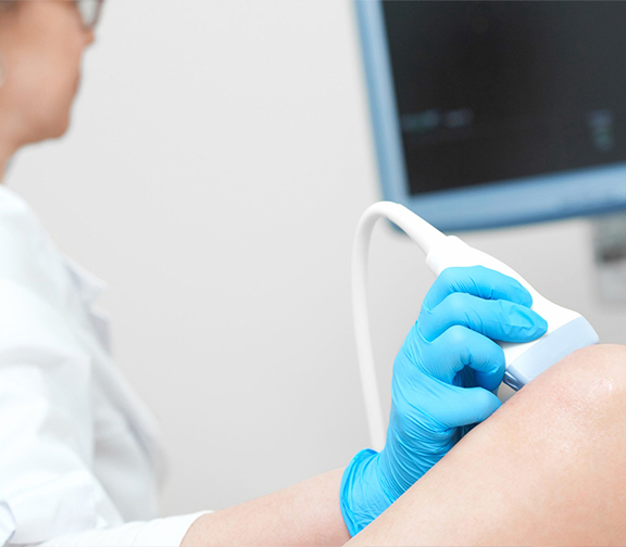 Doppler Vascular Arterial ou Venoso de Membros Inferiores ou Superiores